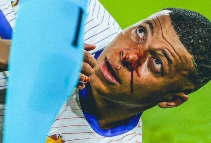 Μεγάλη η ζημιά του Μπαπέ για τους Γάλλους!